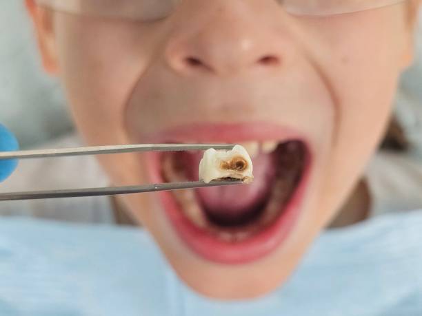 Best Tooth Pain Emergency Relief  in Edmonston, MD